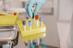 Analiza de fibrinogen: ce este și ce arată o valoare crescută?